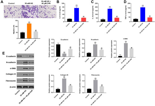 Figure 2 CHR inhibited the EMT process in HG-treated AB8/13 cells in vitro. (A) Cell migration was tested by transwell assay. (B–D) The levels of IL-6, IL-1β and TNF-α in supernatants of AB8/13 cells were detected by ELISA. (E) The protein expressions of E-cadherin, N-cadherin, α-SMA, Collagen III and Fibronectin in podocytes were detected by Western blot. The relative protein expressions were quantified by normalizing to β-actin. **P < 0.01 compared to control. ##P < 0.01 compared to 30 mM HG.