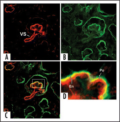 Figure 9 Separate confocal images of the same hybrid glomerulus, dually labeled for laminin α1 (green) and laminin α5 (red). Note laminin α5 presence in vascular stalk (VS) as well as GBM. A higher power view of merged image (C) is shown in (D). GBM in glomerular hybrid is stratified; laminin α5 is on endothelial surface, whereas laminin α1 (which ordinarily is not present in capillary loop stage glomeruli) occupies podocyte surface of GBM. Central areas of signal overlap appear yellow. Reproduced with permission (ref. Citation100).