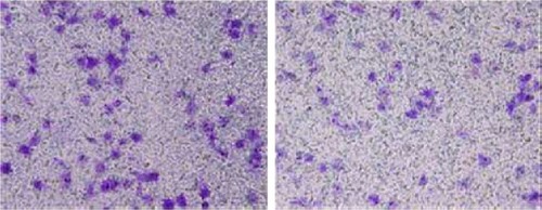 Figure 3 Expression of p53 protein in pathological tissues as detected by immunohistochemistry method (400×).