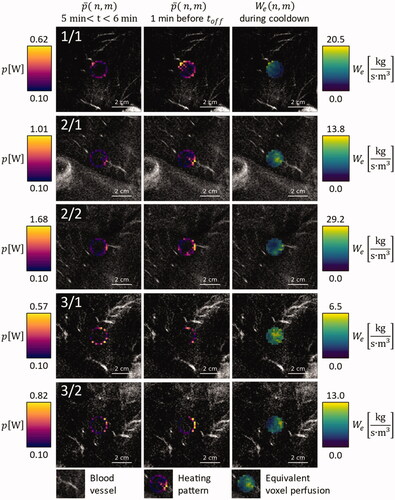 Figure 3. Overlay on contrast enhanced MRI images of the respective anatomical region, for animals 1, 2, and 3: Average power application pattern during the first minute after warmup (leftmost column), during the last minute before HIFU shutdown (middle column) and equivalent voxel perfusion during the first minute of cooldown (rightmost column).