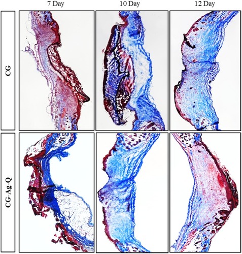 Figure 6 MT staining images of the skin tissues at days 7, 10, and 12 post-surgery in the CG and CG-Ag-Q groups.