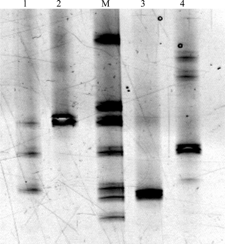 Figure 1. PCR‐DGGE analysis of 4 Helicobacter positive liver specimens. Lanes: M(mobility)‐Ladder, DNA amplified from reference Helicobacter spp. which consists from top to the bottom of PCR products amplified from H. muridarum (CCUG 29262), H. bilis (CCUG 38995), H. pullorum (NCTC 12825), H. pylori (CCUG 17875), ‘H. rappini’ (CCUG 23435), H. hepaticus (CCUG 33637) and H. bizzozeronii (AF 53). 1: F3A (H. pullorum), F3B (H. pylori), F3C (Helicobacter sp. ‘Flexispira taxon. 8’). 2: F4 (H. pullorum). 3: F11 (H. hepaticus). 4: F17 (H. pylori).