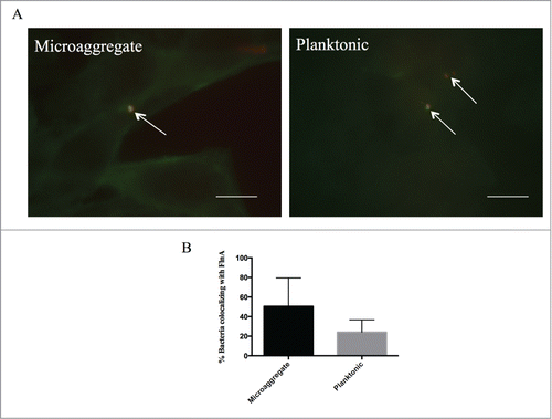 Figure 3. Microaggregates and planktonic MAH colocalize with host protein filamin A during infection of Hep-2 cells. Immunofluoresnce microscopy was used to examine the colocalization between filamin A and MAC104 microaggregates and planktonic bacteria. White arrows indicate bacteria (red) and filamin A (green). White bar = 10 μm. (B) Average levels of filamin A colocalization with MAC104 were calculated from the visualization of 10 randomly selected fields for each bacterial phenotype from 2 independent experiments. Percentages shown represent the number of total bacteria associated with filamin A divided by the total number of bacteria.