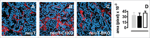 Figure 3. The dispensable role of the classical complement activation pathway in neuT tumor immunosurveillance. C3 fragment deposition at the tumor site is not altered in the absence of C1q or antibodies. (A–C) Confocal microscopy images representative of frozen tumor sections from mammary glands of 17-week-old neuT (A), neuT-C1KO (B), and neuT-BKO (C) mice labeled with anti-C3b/iC3b/C3c antibody (red) and TO-PRO®-3 iodide (blue). Magnification × 400. C3 fragment deposition was quantified (D) in neuT (gray bar), neuT-C1KO (black bar), and neuT-BKO (white bar) mice (n = 10 each group). No differences in C3 fragments deposition were found (p = ns, two-tailed Student's t-test). Results are represented as means ± SEM from 3 × 400 microscopic fields per sample.