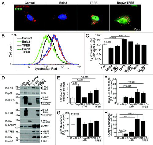 Figure 5. BNIP3-induced autophagy is associated with reduced lysosome abundance, which is restored by co-expression of TFEB. (A) Representative epiflourescence images (630X) demonstrating lysosome distribution (by LysoTracker red staining) in cells adenovirally transduced with Bnip3, TFEB (green, at 100 MOI), BNIP3+TFEB (at 100 MOI each) for 48 h. Nuclei are blue (Hoechst dye). Adenovirus coding for LacZ expression was added as necessary to result in equivalent MOIs (at total 200 MOI per treatment). (B) Flow cytometric analysis of LysoTracker red staining in cells treated as in (A). Control is depicted in black, BNIP3 in green, TFEB in red and BNIP3+TFEB in blue. (C) Assessment of LysotTracker red expression by flow cytometry in NRCMs expressing BNIP3, BNIP3 ΔTM, TFEB, BNIP+TFEB for 48 h; and in BNIP3 expressing cells treated for 24 h with 3MA (7 mmol/L). (D) Representative immunoblots demonstrating LC3, p62, BNIP3 (FLAG), BNIP3ΔTM (HA), TFEB (both rat TFEB and HA tagged human TFEB) and LAMP1 expression, with α-sarcomeric actin (αSA) in NRCMs adenovirally transduced with LacZ (control), BNIP3, BNIP3ΔTM, TFEB and BNIP3+TFEB as in (A) (for 48 h). (E–H) Quantitative assessment of LC3-II/α-sarcomeric actin ratio (E), total LC3 (F), p62 (G) and LAMP1 (H) abundance in NRCMs treated as in D (n = 3–7/group). p values are by post-hoc test.