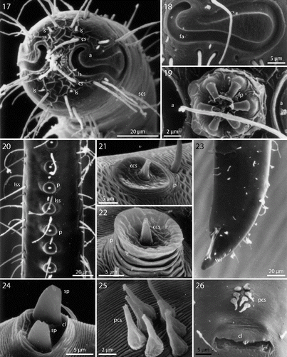 Figs. 17–26. Robbea hypermnestra sp. nov. Male. 17. Head, in face view; 18. Amphidial fovea; 19. Mouth opening with fingerlike papillae; 20. Row of ventral sucker-shaped papillae; 21. Papilla withdrawn; 22. Papilla extended; 23. Tail; 24. Tips of spicule protruding from cloaca; 25. Group of precloacal setae; 26. Cloaca and precloacal setae. SEM.
