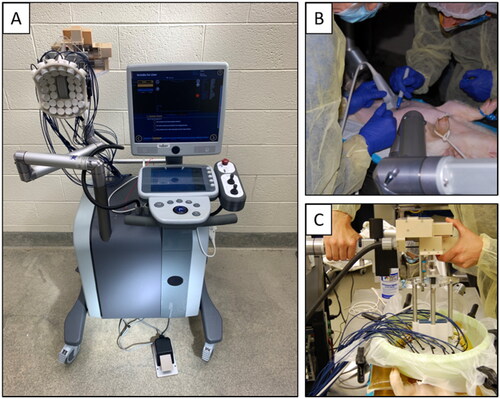 Figure 2. Histotripsy Therapy System. Clinical histotripsy cart with 500 kHz transducer and coaxial US imaging probe mounted onto a micro-positioner (A) freehand imaging by a radiologist to identify acoustic window (B). UMC bowl with therapy transducer submerged via an adjustable arm (C).