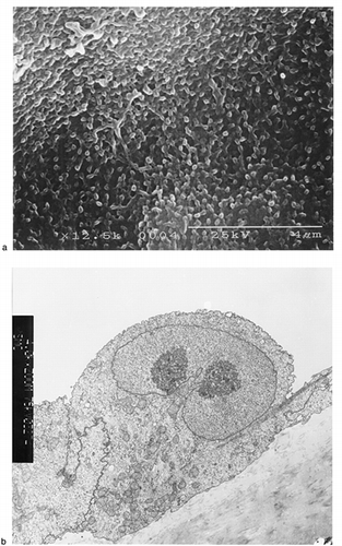 Figure 2. Electron microscopic findings of cultured renal tubular cells. a) The cell surfaces were covered by many short microvilli. b) Occasionally, lateral digitations were located between adjacent cells.