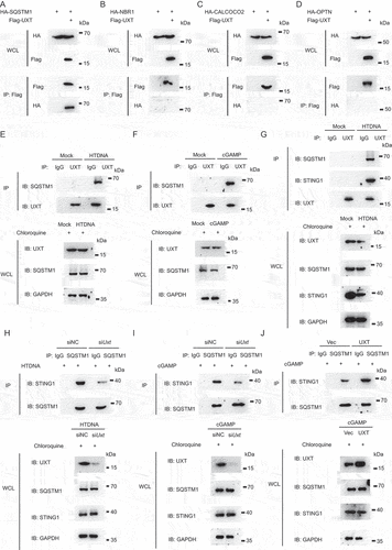 Figure 6. UXT facilitates the interaction of SQSTM1 and STING1. (A, B, C and D) HEK293T cells were transfected with the indicated plasmids. Then, cell lysates were immunoprecipitated with an anti-Flag antibody and then immunoblotted with the indicated antibodies. (E) MEFs were treated with chloroquine and then stimulated with HTDNA for 3 h, and the cell lysates were immunoprecipitated with an anti-UXT antibody or normal IgG, and then immunoblotted with the indicated antibodies. (F) MEFs were treated with chloroquine and then stimulated with cGAMP for 3 h, and the cell lysates were immunoprecipitated with an anti-UXT antibody or normal IgG, and then immunoblotted with the indicated antibodies. (G) MEFs were treated with chloroquine and then stimulated with HTDNA for 3 h, and the cell lysates were immunoprecipitated with an anti-UXT antibody or normal IgG, and then immunoblotted with the indicated antibodies. (H) MEFs transfected negative control (NC) or Uxt siRNAs were treated with chloroquine and then stimulated with HTDNA (2 μg per well) for 3 h, and the cell lysates were immunoprecipitated with an anti-SQSTM1 antibody or normal IgG, and then immunoblotted with the indicated antibodies. (I) MEFs transfected negative control (NC) or Uxt siRNAs were treated with chloroquine and then stimulated with cGAMP (2 μg per well) for 3 h, and the cell lysates were immunoprecipitated with an anti-SQSTM1 antibody or normal IgG, and then immunoblotted with the indicated antibodies. (J) MEFs transfected control vectors (Vec) or UXT expression plasmids (UXT) were treated with chloroquine and then stimulated with cGAMP (2 μg per well) for 3 h, and the cell lysates were immunoprecipitated with an anti-SQSTM1 antibody or normal IgG, and then immunoblotted with the indicated antibodies.