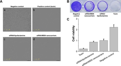 Figure 8 Evaluation of gene knockdown efficiency by siRNA delivered by MSN nanocarriers.Notes: (A) Live cell IncuCyte ZOOM® monitoring of cell growth for 120 h upon treatment with MSN nanocarriers loaded with AllStars Hs Cell Death Control siRNA. Live images with each treatment after 120 h (A(a–d)). (B) Crystal violet staining of cells at 120 h final time point. (C) Biochemical cell viability assay performed with WST-1 assay after 120 h. Negative control cells (untreated) were observed to grow normally and were mostly confluent. Positive control cells in the presence of staurosporine (cell growth inhibitor) had ceased to grow. Efficient inhibition of cell growth was observed with MSN nanocarriers loaded with AllStars Hs Cell Death Control siRNA. As comparison, commercial transfection agent complexed AllStars Hs Cell Death Control siRNA-treated cells served as a positive transfection control.Abbreviations: siRNA, small interfering RNA; MSN, mesoporous silica nanoparticle.