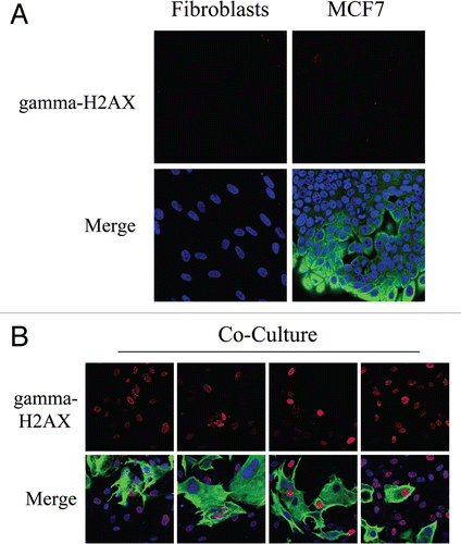Figure 3 Fibroblast-MCF7 co-cultures show increased DNA damage, as evidenced by DNA double strand break foci. (A and B) Increased gamma-H2AX staining in co-cultured fibroblasts. To detect DNA double strand breaks, co-cultures of hteRt-fibroblasts and MCF7 cells and corresponding homotypic cultures were immunostained with anti-gamma-H2AX (red) and anti-K8/18 (green, detecting tumor epithelial cells) antibodies. DAPI was used to stain nuclei (blue). Importantly, images were acquired using identical exposure settings. Upper panels show only the red channel to appreciate gamma-H2AX staining, while the lower panels show the merged images. (A) Gamma-H2AX is undetectable in mono-cultures of fibroblasts and MCF7 cells. (B) High levels of DNA double strand breaks are detected in most co-cultured fibroblasts and in many MCF7 cells. Original magnification, 40x.