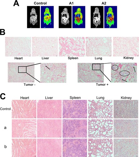 Figure 8 Magnetic targeting and histological analysis.Notes: (A) T1-weighted MRI images of mice: control, postinjection (A1), and 2-h postinjection with NIB magnet for 30 min (A2). (B) Prussian blue-stained images; the circles and arrows indicate the locations of nanocomposites in the tumor site. (C) The histological characteristics of the main organs after treatment with 1 mg/mL MSN (a) and nanocomposites (b) once a day for 5 days (×200).Abbreviations: MRI, magnetic resonance image; MMSN, magnetic mesoporous silica nanoparticle; NIB, neodymium, iron and boron magnet; MSN, mesoporous silica nanoparticle; H&E, hematoxylin and eosin.