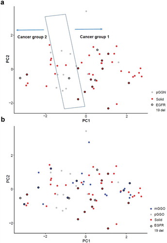 Figure 4. Principal component analysis (PCA). (a) PCA of pure ground-glass nodule (pGGN) samples and solid samples. (b) PCA of all malignant nodules, including pGGNs, mixed ground-glass nodules (mGGNs), and solid samples.