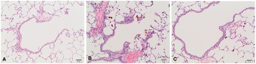 Figure 7. Histopathological findings in the lung of animals treated with coarse meta-chloro DPP pigment (30 mg/m³) after 5 days (A and B) and after a 3-week recovery period (C); H&E, 200×. (A) Terminal bronchiole of a control animal. (B) Epithelial hypertrophy of the terminal bronchiole and increased number of pigment-laden macrophages in a treated animal. (C) Regression of the epithelial hypertrophy of the terminal bronchiole and reduction of the number of pigment-laden macrophages.