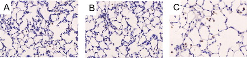 Figure 2. Expression of VEGF in rat lungs Notes: Expression of VEGF in rat lungs was detected by immunohistochemistry. (A) Control rats receiving normal CD4 + T cells, adjuvant and PBS; (B) Rats receiving adjuvant and PBS; (C) Rats receiving CD4 + T cells hypomethylated, adjuvant and PBS. Data presented were one representative image data. Magnification: 400×. Abbreviations: VEGF, Vascular endothelial growth factor; PBS, phosphate buffered saline.