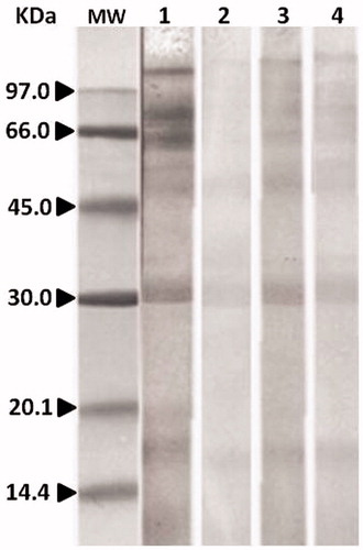 Figure 4. Immunoblotting inhibition assays. Lane MW = molecular weight marker. Lane 1: H. lepturus venom incubated with pooled serum without inhibitor (negative control). Lane 2: H. lepturus venom incubated with pooled serum (from patients 1, 3, 6, 7, 9, and 11) containing 100 µg/ml of H. lepturus venom as inhibitor (positive control). Lane 3: H. lepturus venom incubated with pooled serum containing 100 µg/ml M. eupeus as inhibitor. Lane 4: H. lepturus venom incubated with pooled serum containing 100 µg/ml A. crassicauda as inhibitor.