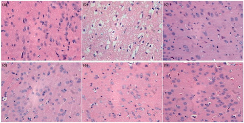 Figure 8. The effect of QNM on the histopathology of brain in rats after cerebral I/R injury shown by HE staining. (a) Sham group; (b) I/R injury group; (c) Positive group; (d) Low-dose group; (e) Medium-dose group; and (f) High-dose group. The original magnification was 400×.