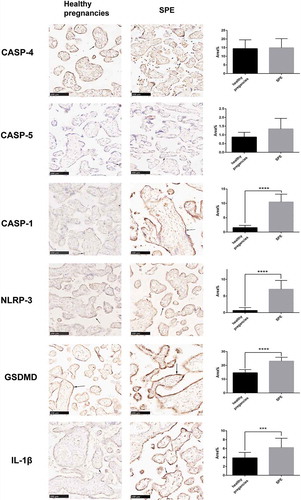Figure 4. Comparison of the expression of pyroptosis protein between SPE and healthy pregnancies analyzed by immunochemistry (IHC). NLRP-3, caspase-5, caspase-1, caspase-4, GSDMD and IL-1β all were mainly located in trophoblastic cells.(***P < .001, ****P < .0001 vs. Healthy pregnancy)