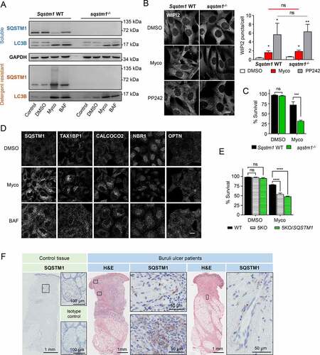 Figure 4. Increased expression of SQSTM1 enhances cell survival in the presence of mycolactone but is not required for initiation of autophagy. Cells were exposed to 31.25 ng/ml mycolactone (Myco), alongside a solvent control (0.05% DMSO, equivalent dilution to the mycolactone) for the longest timepoint tested. All immunofluorescence images were obtained using a Nikon A1 confocal laser scanning microscope (scale bar: 10 µm). For all immunoblots, the migration relative to known molecular mass markers is shown. For all panels, unless otherwise indicated, statistical comparisons are to the DMSO-treated cells of that particular cell type, ns = not significant; * = p< 0.05; ** = p< 0.01; *** = p < 0.001; **** = p < 0.0001.(A-C) Matched Sqstm1 WT and sqstm1−/- MEFs were exposed to mycolactone for the indicated times. As controls, either 100 nM bafilomycin A1 (BAF) for 12 h or 1 µM PP242 for 1 h were used, as indicated. (A) Cells were harvested in RIPA lysis buffer, then soluble and insoluble fractions were prepared as described in Methods prior to immunoblotting. Migration relative to known molecular mass markers is shown. Twelve-hour mycolactone exposure. Data are representative of 3 independent experiments. (B) Cells were fixed and stained for WIPI2 after 8 h mycolactone exposure. Values represent the means of 3 independent experiments ± SEM. (C) Cell viability in Sqstm1 WT and sqstm1−/- MEF as measured by CellEvent assay after 24 h mycolactone exposure. Values represent the mean of 3 independent experiments ± SEM. (D) WT HeLa cells exposed to mycolactone for 16 h before fixing with PFA for immunofluorescent staining with mouse anti-SQSTM1, anti-TAX1BP1, anti-CALCOCO2, anti-NBR1 or anti-OPTN antibodies. Data are representative of duplicate experiments. (E) Cell viability for parental HeLa (WT), PentaKO cells (5KO) and PentaKO cells with reconstituted SQSTM1 expression (5KO/SQSTM1) as measured by CellEvent assay after 48 h mycolactone exposure. Values represent the mean of 3 independent experiments ± SEM. (F) Skin sections from samples from healthy donor (left hand panel) and Buruli ulcer patient lesions (right hand panels), stained with anti-SQSTM1 antibody or isotype-matched control. Boxes show locations of magnified SQSTM1-stained sections. Comparable results were found for all 8 patient biopsies analyzed regardless of whether the lesion was an ulcer or a plaque.