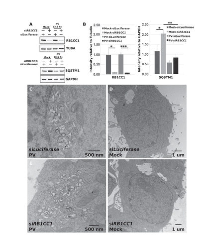 Figure 3. PV induces cellular membrane rearrangement in the absence of RB1CC1. HEK-293T cells were transfected with siRNA against Luciferase or RB1CC1 and incubated for 48 h. Cells were then collected for western blot verification of knockdown (a and b). (a) Representative western blots of RB1CC1 and SQSTM1 levels in mock- and PV-infected transfected cells. (b) Densitometry analysis of western blots from (a). Error bars represent the standard error of the mean of n = 3 independent experiments. Statistical significance was determined via a two-tailed paired Student’s t-test where * p < 0.05, ** p < 0.01, and *** p < 0.001. Concurrent transfected cells were mock infected (d and f) or infected with poliovirus (c and e) for 3.5 h before being fixed and prepared for transmission EM imaging. (c-f) Representative EM images of mock- or PV-infected transfected cells. Replicate images are supplied in Figure S3.