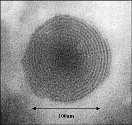 FIG. 3. TE micrograph of a testosterone ethosomal vesicle.