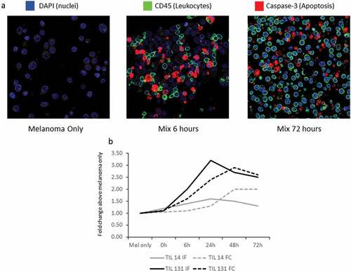 Figure 3. ICCM representation of TILs cytotoxic activity. (a) Immuno-fluorescence (IF) stain of ICCM time-points of Proficient Killing Pair (PKP), acquired at zoom x630: Blue – DAPI, green – CD45 (a leukocyte marker), and red – Caspase-3 (Cas-3, a marker of immune-induced apoptosis). This IF staining reflects very low melanoma cell death in the melanoma-only sample and high melanoma cell death after co-culturing. Lymphocytes do not express signs of cell death. (b) Dynamics in mean fluorescence intensity of Cas-3 IF stain and of 7-Aminoactinomycin D (7-AAD) flow cytometry (FC). Y-axis represents fold-change in mean fluorescence intensity, which was calculated as the mean fluorescence intensity in a certain time point divided by the mean fluorescence intensity of “melanoma only” sample. Cells from the exact same co-cultures were used for the FC and for construction of the ICCM block. Cas-3, a protease that initiates apoptosis, peaked 24 h since killing assay initiation. 7-AAD, which binds to dying or dead cells, peaked at 48 h, after Cas-3 activity resulted in cellular death