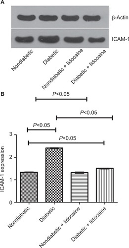 Figure 4 ICAM-1 expression on the surface of Kupffer cells in nondiabetic and diabetic mice.