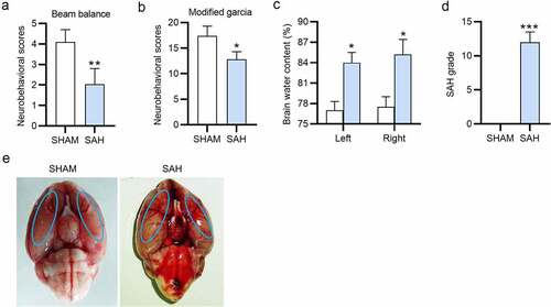 Figure 2. The neurobehavioral scores and SAH grading of the SAH rats. (a) The beam balance scores of the sham and SAH rats. (b) The neurobehavioral scores of the sham and SAH rats. (c) The brain water content (%) of the sham and SAH rats. (d) The SAH grade of the sham and SAH rats. (e) The macroscopic pictures of the brains isolated from sham and rats after surgery for 24 h. There are 10 rats in each group. *P < 0.05, **P < 0.01, ***P < 0.001