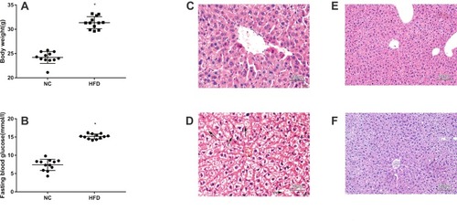 Figure 2 Physiological and histological assays of mice with HFD-induced NAFLD that were not treated with liraglutide. (A) Body weight of mice with HFD-induced NAFLD that were not treated with liraglutide (means±SD, n =12). (B) Fasting blood glucose levels in mice with HFD-induced NAFLD mice that were not treated with liraglutide (means±SD, n =12). Histological sections of liver tissues stained with HE from animals fed the normal rodent chow diet (C and E) or HFD (D and F) without the liraglutide treatment (C: ×400, D: ×400, E: ×200, F: ×200). *P<0.05.