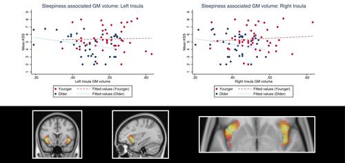 Figure 3 Demonstration of sleepiness (KSS scores)-associated insula gray matter volume in younger and older adults. The plots show the age interaction effect suggesting that sleepiness is positively associated with left and right insula gray matter volume in younger adults, but negatively associated in older individuals. The colors in the brain plot represent statistical t-values ranging from 0 (black) to 4.5 (white).Abbreviation: KSS, Karolinska Sleepiness Scale.