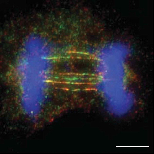 Figure 2. HR-UFBs arise in resolvase-deficient cells. U2OS cells were treated with siRNA against MUS81 and GEN1 to inactivate the SMX and GEN1 Holliday junction resolvases. 24 hours after siRNA transfection, the cells were treated with cisplatin (1 μM for 1 h and released into fresh media for 24 h) in order to induce DNA damage. RPA2, BLM and DNA were visualized using anti-RPA2 antibody (green), anti-BLM antibody (red), and DAPI (blue). Images were acquired using a Zeiss AXIO imager M2 microscope. Scale bar, 10 μm. For detailed methods, see Chan et al., 2018.