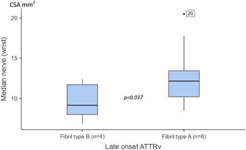 Figure 3. Boxplots showing cross-section areas (CSA) at the median nerve (wrist) between patients with late onset hereditary transthyretin amyloidosis (ATTRv), having fibril-type A and type B. The box shows median and percentage between 25 and 75. The whiskers showing the 95% confidence interval (numbers indicating CSA data outside the 95% confidence interval).