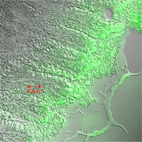 Figure 7 Confocal laser scanning microscopy image of Peyer’s patches cross-sections prepared 4 h after oral administration of coumarin-6-loaded PLGA NP composite microcapsules.Abbreviations: NP, nanoparticle; PLGA, poly(lactide-co-glycolide).
