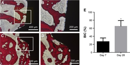 Figure 7 Histological observation of bone-implant interface for G/nHA/PA66 screws 7 (A, B) and 28 days (C, D) after operation (100×). The BIC was calculated (E).Note: *P<0.05 compared to the respective control (n=4 specimens/group).Abbreviations: BIC, bone-implant contact; G/nHA/PA66, graphene/nanohydroxyapatite/polyamide66.