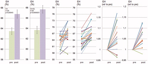 Figure 4. Spironolactone does not prevent cilostamide-induced endolymphatic hydrops in CBA/J mice. CBA/J mice were treated chronically with cilostamide with or without SL for 28 d and thereafter analyzed using MRI. Quantification of endolymphatic and perilymphatic cochlear compartments before and after cilostamide (Cil) and before and after cilostamide plus spironolactone (Cil + SL) administration was performed as described in Material and methods and in Figure 1. Data are presented as means (left), as individual values for each ear before and after treatment (middle) and as individual values for each ear with prevalues set to 1 (right).