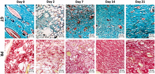 Figure 1. Collagen accumulation in wound areas at day 0, 2, 7, 14 and 21 after wounding. Representative photomicrograph of wounds tissue sections stained with Gomori’s trichrome (GT) and picrosirius red (PR) staining (100×). Note the collagen intensity and disposition of fibres stained blue and red, respectively.