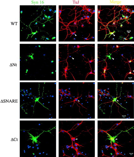 Figure 6.  The effect of Syn 16-ΔNt over-expression on the integrity of neuronal specific βIII-tubulin. Primary cortical neurons transfected at 3DIV and fixed at 7DIV were labeled for Syn 16 (FITC, green) and βIII-tubulin (TuJ) (Texas Red, red). In neurons over-expressing wild type Syn 16, βIII-tubulin staining could be found in both the soma and the neurites (arrowheads, top panel, third panel and bottom panel). In contrast, neurons over-expressing Syn 16-ΔNt appear to have diminished βIII-tubulin staining (arrowhead, second panel). The arrows points to untransfected neighbors of the transfected cell. Scale bar = 20 µm.