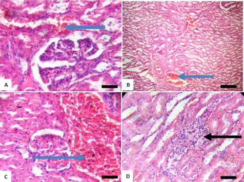Figure 8. Photomicrograph showing kidneys of rats post withdrawal of sodium arsenite for 4 weeks. (A) Control with mild congestion of blood vessel (blue arrow); (B) 10 mg/kg NaAsO2 shows congestion of vessel (blue arrow); (C) 20 mg/kg NaAsO2 with marked disseminated congestion of blood vessel (blue arrow) and (D) 40 mg/kg NaAsO2 shows focal area of peritubular inflammation (black arrow). Scale bar (A, B, C and D) = 2.15 × 2.79 mm. Plates are stained with H and E stains and viewed with ×100 objectives.