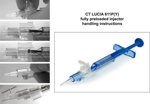 Figure 2 The fully preloaded injector (Blueject 2.0) by Zeiss Meditec (Jena, Germany).