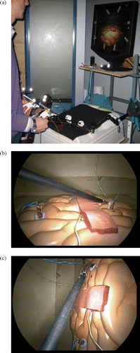 Figure 1. Experiment setup showing the arrangement of the IR sensors in relation to the laparoscope tools (a), and the plastic small bowel model with a simulated omental flap with and without the camera view being rotated (b, c). [Color version available online.]
