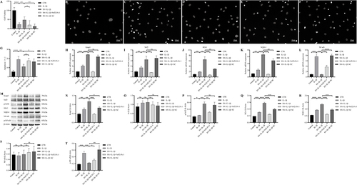 Figure 4 SN suppressed IL-1β-induced apoptosis of NPCs by modulating the Keap1/Nrf2 and NF-κB signaling pathways. (A) The CCK-8 assay was employed to determine the activity of NPCs in each group, with data presented as mean ± standard deviation and six replicates per group. (B-G) Apoptosis of NPCs in each group was assessed by Hoechst staining. The scale bar was 100μm in length. (H-L) mRNA transcription levels of Nrf2/HO-1 and NF-κB signaling pathway-related proteins were evaluated. (M-T) Expression and quantification analysis of Nrf2/HO-1 and NF-κB signaling pathway-related proteins were conducted, with β-actin serving as a reference. * indicates P <0.05, ** indicates P < 0.01, *** indicates P < 0.001, **** indicates P < 0.0001, NS, differences are not statistically significant.