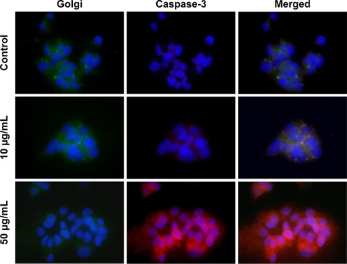 Figure 5 The concomitent detection of Golgi apparatus function and caspase 3 pathway.Notes: Upper row: control sample (no Alb-GNPs exposure: low red fluorescence is visible, suggesting that Hep G2 cells have low apoptotic state under normal conditions; in contrast Golgi function is normal as suggested by green fluorescence. Middle row: exposure to 10 μg/mL Alb-GNPs (1 hour, 37°C), followed by laser excitation (3 minutes, 808 nm, 2W/cm2). Lower green fluorescence intensity staining combined with increased red fluorescence suggest low Golgi function with moderate activation of caspase 3 pathway. Bottom row: exposure to 50 μg/mL Alb-GNPs (1 hour, 37°C), followed by laser excitation (3 minutes, 808 nm, 2W/cm2). The majority of cells present intense, inhomogenuous, granular aspect of red fluorescence with lack of fluorescence staining suggesting an intense activation of caspase 3 apoptotic pathway. Magnification: 60×.Abbreviation: Alb-GNPs, albumin-conjugated gold nanoparticles.