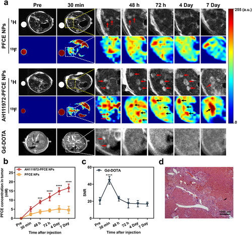 Figure 5 Precise detection and long tumor retention of AH111972-PFCE NPs for colorectal liver metastases. (a) 1H MR and colocalized 19F MR images of the liver metastases murine model in AH111972-PFCE NPs and PFCE NPs groups as well as 1H MR images of the liver metastases murine model in Gd-DOTA group (n = 3/group), red or black arrows indicate the metastases sites. For each mouse, 100 µL of AH111972-PFCE NPs or PFCE NPs or 4 µL of Gd-DOTA were injected intravenously via the tail vein. (b) Quantitative analysis of PFCE concentration of liver metastases in mice before and after the administration of c-Met-targeting and non-targeting PFCE nanoparticles. (c) Quantitative analysis of SNR of liver metastases in mice before and after Gd-DOTA injection. (d) H&E staining of liver with metastases in murine model with AH111972-PFCE NPs administration; Scale bar is 1000 µm. Data were expressed as mean ± SD, ***P < 0.001, ****P < 0.0001.