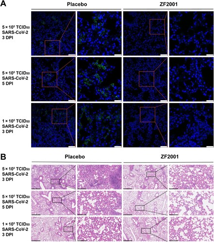 Figure 3. Immunofluorescence and histopathology analyses of lung tissues in mice. (A) Immunofluorescence analysis of lung tissue section stained with anti-SARS-CoV-2 nucleoprotein (N) antibody. Green: SARS-CoV-2 N protein; Blue: DAPI. Scale bar in low magniﬁcations images, 90 μm. Scale bar in high magniﬁcations images, 30 μm. (B) Typical histopathology images of lung tissues section shown by haematoxylin-eosin staining. Both low magniﬁcations and high magniﬁcations are shown, highlighted by boxes. Scale bar in low magniﬁcations images, 625 μm. Scale bar in high magniﬁcations images, 100 μm.