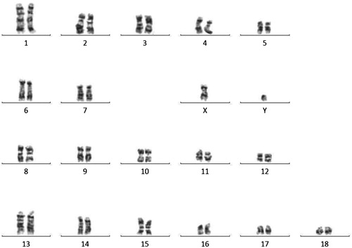 Figure 6. Correct karyotype of #308 pig from the F0 generation, TG308 (2n = 38, XY). The resulting chromosome bands were analysed using a microscope with a camera (Axio Imager M.2, Carl Zeiss Microscopy GmbH, Germany) and appropriate software (Ikaros).