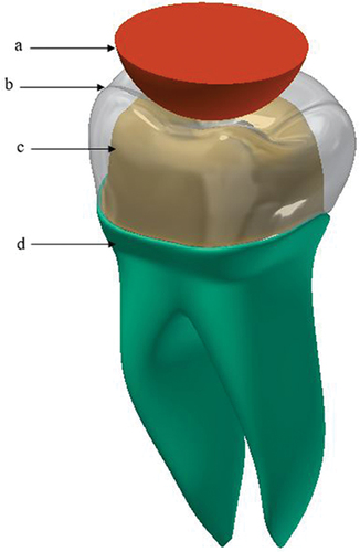 Figure 2. 3D model of the restored first molar, (a) indenter, (b) crown, (c) dentin, (d) root.