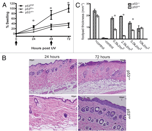 Figure 1 Mutant p53P/P mice are hypersensitive to UVB radiation. (A) Mice were shaved and irradiated with 4.5 kJ/m2 of UVB at 0 and 48 h. Skin swelling was determined by measuring double skin-fold thickness of the dorsal skin at indicated time points. N = 5 per group. Data are the mean ± SEM, *indicates p < 0.05 vs. wild-type. (B) Representative H&E counterstaining of irradiated dorsal skin sections after indicated time points. Magnification, 20X. (C) UVB induced suppression of DTH. Mice were treated with UVB and later were immunized with Candida albicans. Hind footpads were measured 10 days later then challenged with an injection of Candida antigen. DTH was measured by footpad swelling 24 hours post-challenge. Negative controls were measured in mice not immunized but challenged. Positive controls were non-irradiated, but immunized and challenged mice. N > 5 per group. Data are the mean ± SEM, *indicates p < 0.005 vs. wild-type.