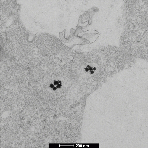 Figure S4 Transmission electron microscopy image showing the uptake of the nanostars within vesicular structures of the cell.