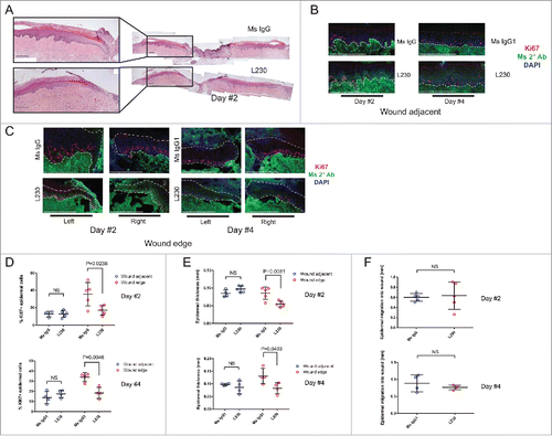 Figure 2. Integrin αv is necessary for proliferation during wound healing of human skin in vivo. (A) Representative Hematoxylin and Eosin (H&E) stains for wounds from mice treated with a control mouse IgG antibody or an L230 antibody. Wounds were harvested 2 days after wounding. B,C. Representative images of Ki67 and mouse secondary antibody labeling of wound adjacent tissue (B) or wound edge tissue (C). Dotted lines indicate the basement membrane zone. (D, E) Quantification of %Ki67+ epidermal cells (D) or epidermal thickness (E) at the wound edge and in wound adjacent tissue. Wound edge was considered within 0.25mm of wound. (F) Quantification of epidermal migration into the wound in mm. N = 4 mice per group for day 2 and 5 mice per group for day 4. NS = not statistically significant. P values were calculated using a student's t-test. Scale bar = 200 µm.