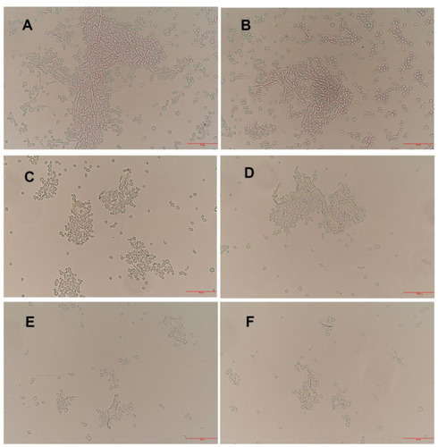 Figure 2 Observation of the morphological changes of C. albicans by optical microscopy (400×). (A and B) Untreated C. albicans cells are healthy, with the budding cells and pseudohyphae. (C and D) and (E and F) C. albicans treated with AMP-17 (40 μg/mL) at 8 h and 16 h, respectively, showed significantly reduced budding cells and filamentous pseudohyphae, and the cells aggregated and lysed. The bars indicate 50 μm.